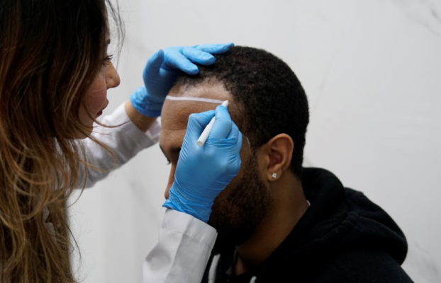 🌟 Afro Haartransplantatie in Turkije – Natuurlijke & Permanente Resultaten